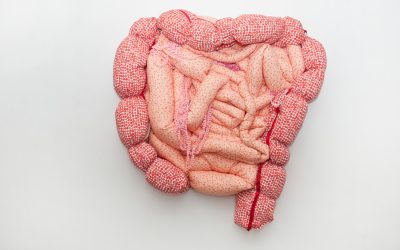 Intestino irritable
