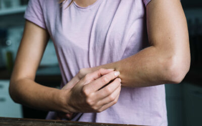 Dermatitis durante el confinamiento